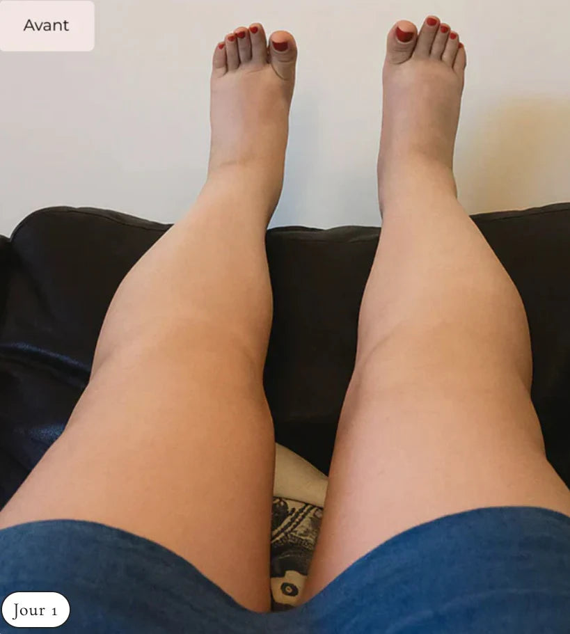 Après